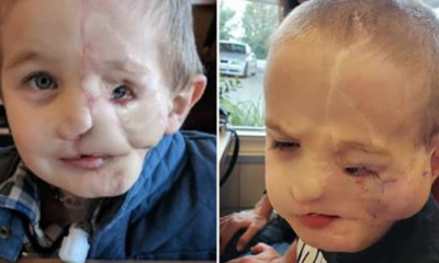 5 Year Old Hero Survived Attack By Two Dogs – Now Cruel People Call Him By This Name