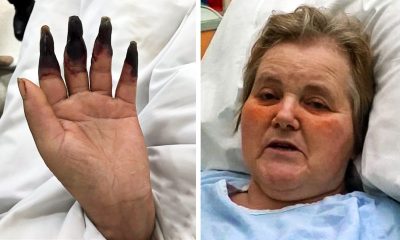 A Healthy Woman Was Cleaning Her House For 2 Hours. Then She Noticed Her Hands and Fingers Turned Dark Black