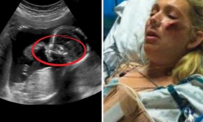 A Mother Dies With Her Baby Inside, But Her Husband Did Something Unbelievable That Changed Everything