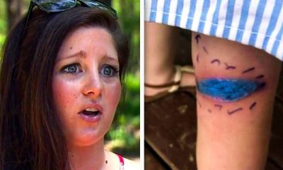 Mom Spots 'Blue Mark' On Her Daughter’s Leg – Rushes Her To Hospital After It Turns Black