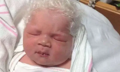 When The Baby Is Born With Snow-White Hair, The Parents Are Unsure Of What To Do