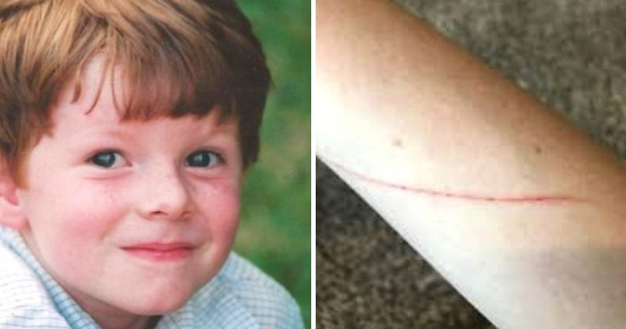 child-got-small-cut-on-his-arm-and-doctors-told-him-it-s-nothing-days