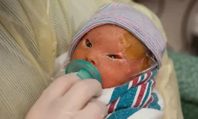 Doctors Told Them Everything Was Fine, But When She Was Born They Were Shocked