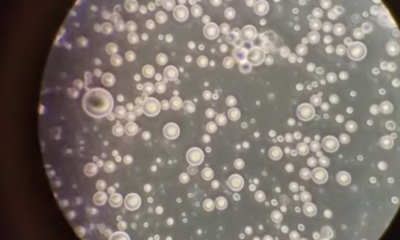 The Stunning Difference Between Breast And Formula Milk Under Microscope Will Shock You