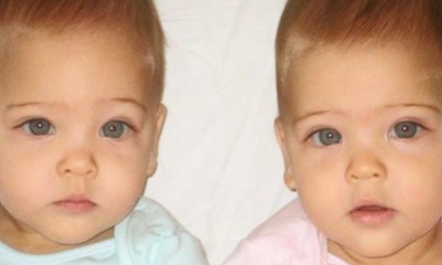12 Years Ago They Were Called The World's Most Beautiful Twins – Now Look At Them