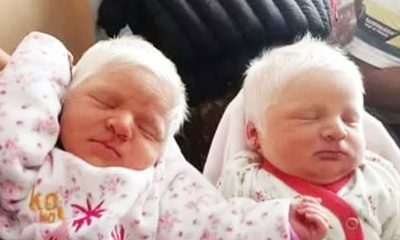 Mom gives birth to rare albino twins with snow-white hair