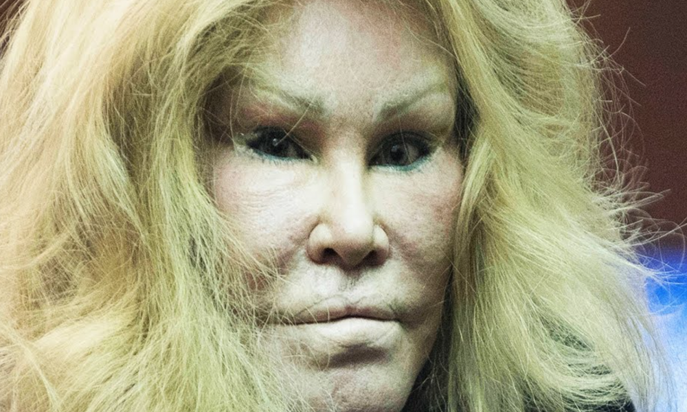 Billionaire Socialite Jocelyn Wildenstein Denies Having Any Surgery