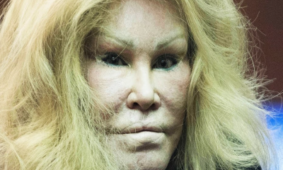 Billionaire Socialite Jocelyn Wildenstein Denies Having Any Surgery, But Wait Until You See How She Looked Like Before