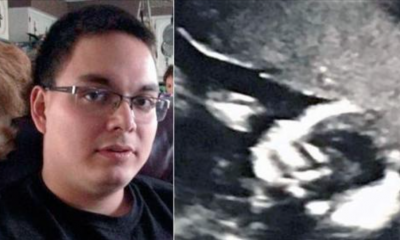 Dad Almost Faints When He Sees The Ultrasound. Nurse Was Shook Saying It's 1 In 15 Million