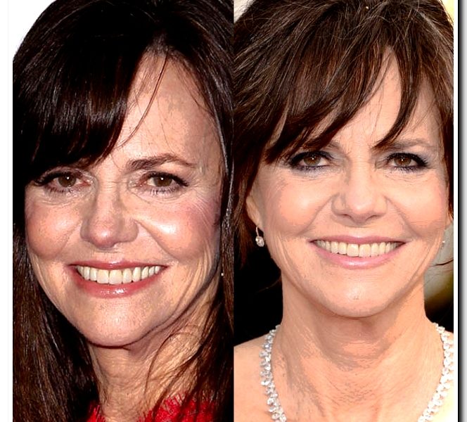 After Undergoing Face Surgery, Sally Field Felt “Young Again” Since Her