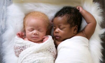 Photographer Gives Birth To Twins, One Black And One White – But Wait Till You See These Beautiful Twins Today