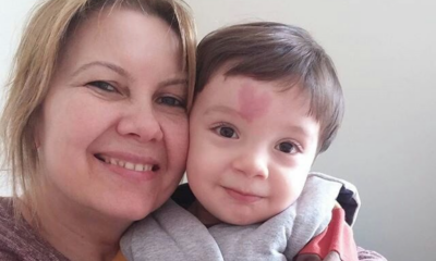 Baby With A Unique Birthmark Is Becoming An Internet Sensation