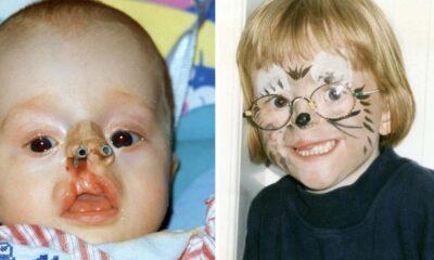 Ilka Brühl Was Born With Rare Facial Defect – But Wait Till You See Her Today