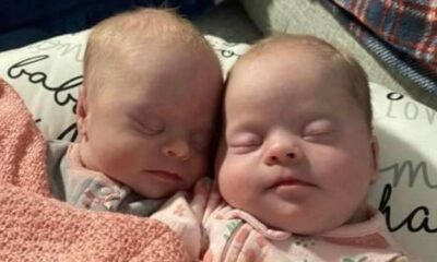 Mom Of Rare Twins With Down Syndrome Shows How Beautiful They Are In Spite Of Critics