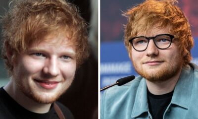 Ed Sheeran Debunks Social Stigma And Speaks Openly About His Disorder