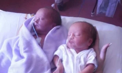 Couple Expects Identical Twins, Freeze When The Doctor Says “I’m Sorry”