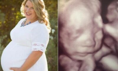 After Her Husband Dies, She Finds Out She’s Pregnant – Then She Sees The Jaw-dropping Ultrasound