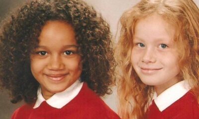 People Don't Believe Twin Girls Are Related - Here's How They Look Today