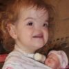 Born Without A Nose, Here’s What Tessa Evans Looks Like At 10