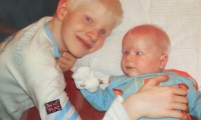 Bera And Tsotne Ivanishvili Were Born With Albinism – But Wait Till You See How They Look Today