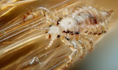 Head Lice Prevention For Children And Adults