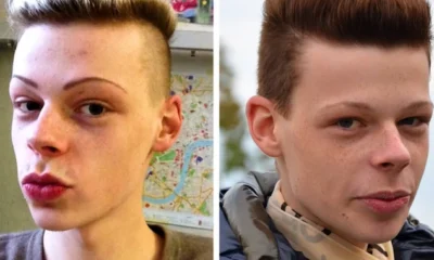 Meet Patrick Mast, Who Spent $73,000 To Look Like a Doll, But Wait Till You See The End Result