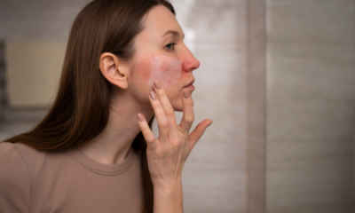 Dermatologists Reveals The Top 9 Tips For Relieving Dry Skin