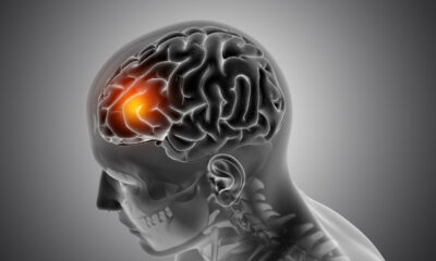 Doctor Shares 30-Second Hand Test That Could Reveal Hidden