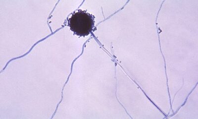 Aspergillus Fungus Threatens Millions As It Spreads