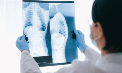 Doctors Stunned After Young Dad Dies With 72 Holes Found