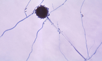 Deadly Airborne Fungus Aspergillus Spreads Rapidly Across Five