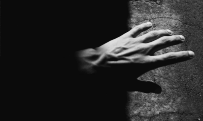 Sudden Vein Appearance: When It’s Normal