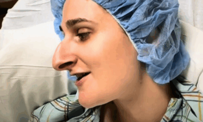 Woman Spends Over A Decade Saving For A Nose Job—But Better Sit Down Before Seeing Her After