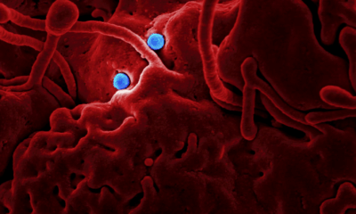 Deadly Bat Virus Claims Teen’s Life In Kerala