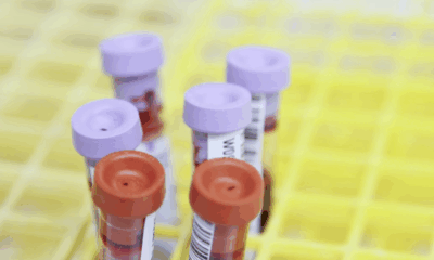 Having This Blood Type Will Make You Age Slower