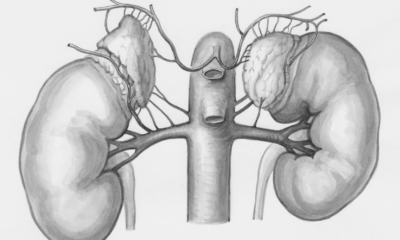 Why Kidney Failure Is Striking The Young—And How To Stop It