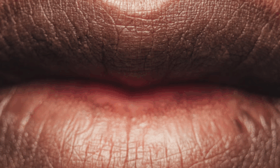 Before And After: Woman With Extreme Lip Enhancements