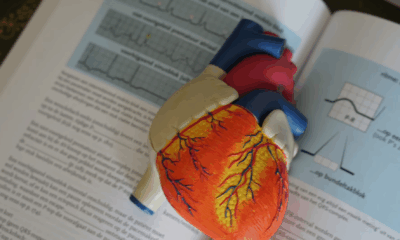 Preventing Stroke At Any Age: 3 “Don’ts” After Meals