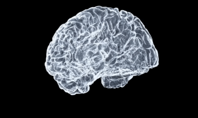 MIT Recently Completed The First Brain-Scan Study On ChatGPT