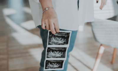 Doctors Stunned By What Appeared On The Ultrasound Screen