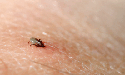 Lone Star Tick Bites: Dangers, Symptoms