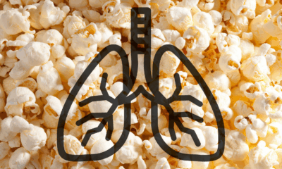 Doctors Warn Of Rising Cases Of “Popcorn Lung” Among Young Adults