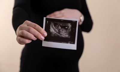 My Doctor Locked The Ultrasound Room Door, Turned The Monitor Around, And Said Four Words