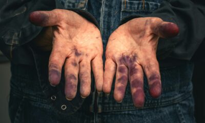 She Was Found “Like A Doll In The Fire”—what Happened Next Shocked Everyone